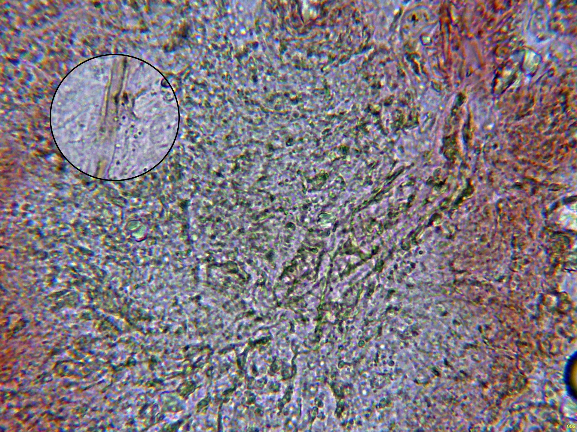 Microscopía de Serpula himantioides - 7 - Hifa basal-002